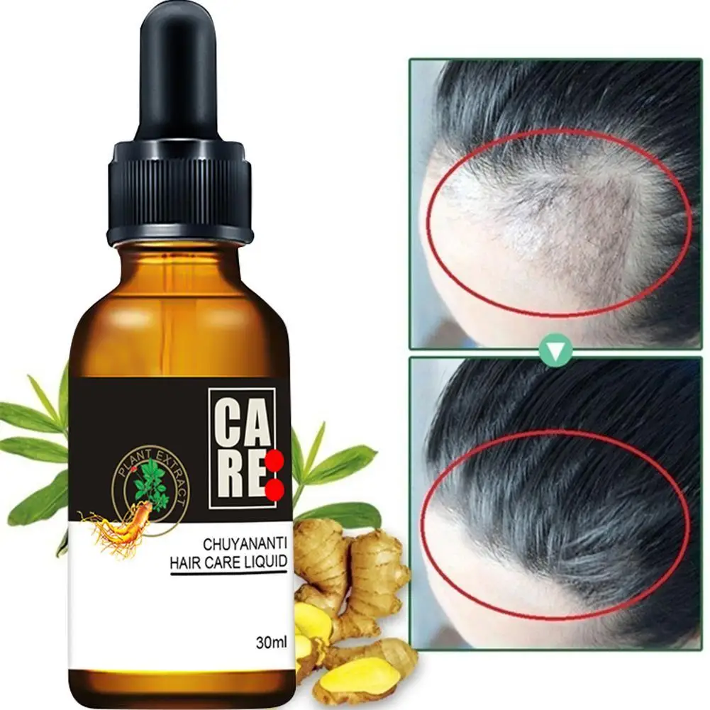 Růst vlasů Olej Podstatu Zahušťovadlo Pro Vlasy Extrakt Růst Růst Vlasů, Vlasy Přírodní Produkt Léčby Ztráta Rostlinných Produktů P9J0 5